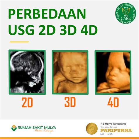 Apa itu USG 4D dan Fungsianya?